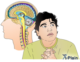 إضطراب الهلع