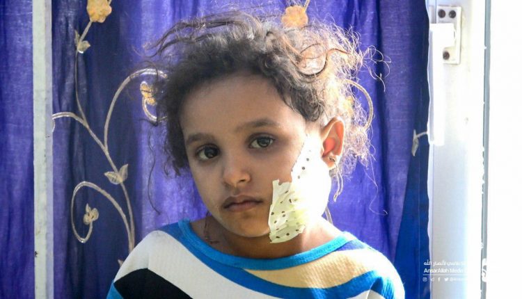 مجزرة مستبا أضحى دامي وجريمة إبادة فاقت كل التصورات3